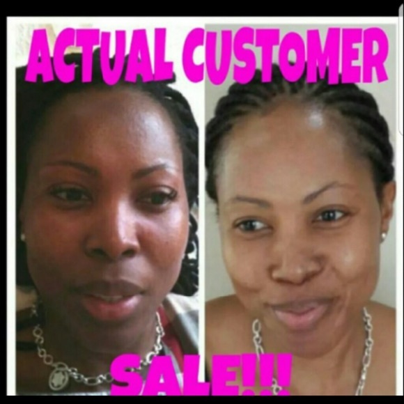 Kojie San Skin Brightening soap - Picture 3 of 7